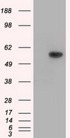 TrkC (NTRK3) antibody