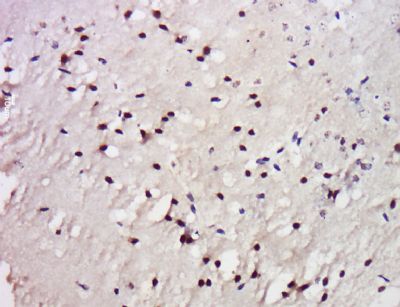 TrkC antibody