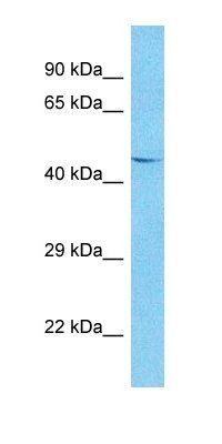 TRM13 antibody