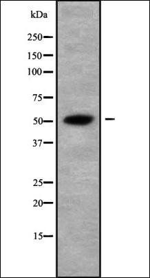 TRMT11 antibody