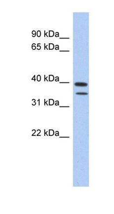 TRMT44 antibody