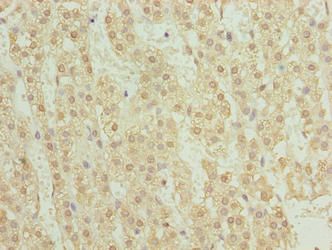TRMT6 Antibody