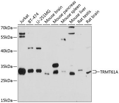 TRMT61A antibody