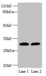 TRNAU1AP antibody