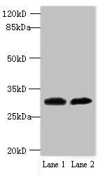 TRNAU1AP Antibody