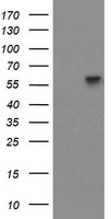 Tropomodulin 1 (TMOD1) antibody
