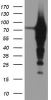 Tropomodulin 1 Antibody