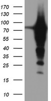 Tropomodulin 1 (TMOD1) antibody