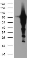 Tropomodulin 1 (TMOD1) antibody