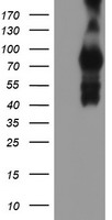Tropomodulin 1 Antibody