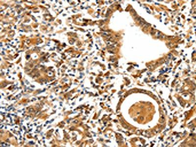 TPM2 Antibody
