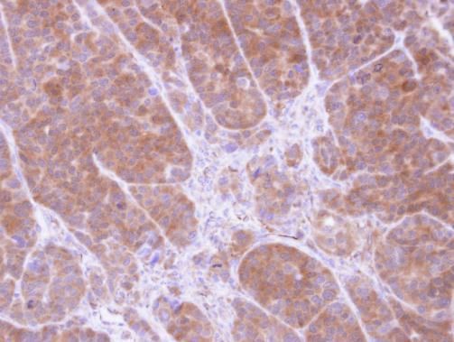 Tropomyosin 2 Rabbit Polyclonal Antibody