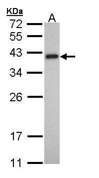Tropomyosin 2 Rabbit Polyclonal Antibody