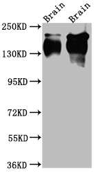 Tropomyosin antibody