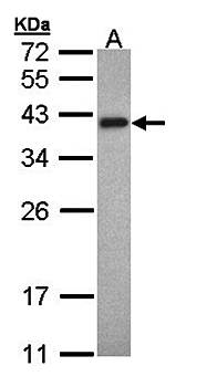Tropomyosin 2 antibody