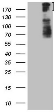 Troponin C1 (TNNC1) antibody