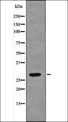 Troponin I Cardiac (Phospho-Ser23+Ser24) antibody