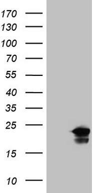 Troponin I fast skeletal muscle (TNNI2) antibody