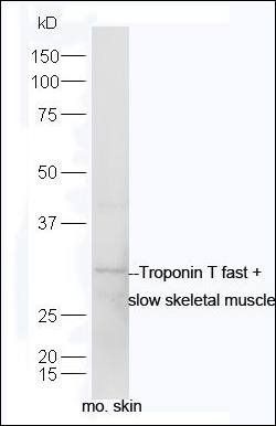 Troponin T fast + slow skeletal muscle antibody