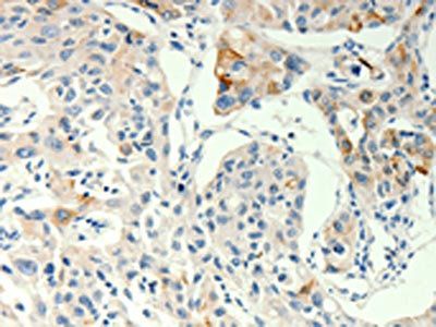 TRPA1 antibody