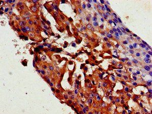 TRPC1 Antibody