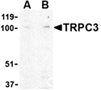 TRPC3 Antibody