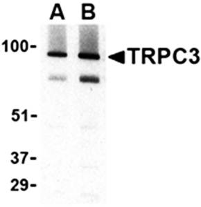 TRPC3 Antibody