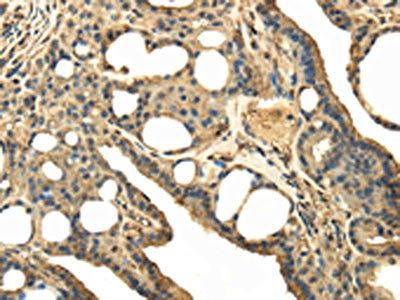 TRPC4AP Antibody