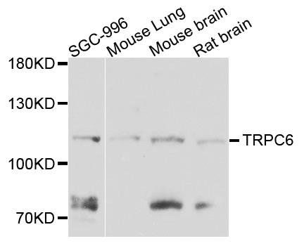 TRPC6 antibody