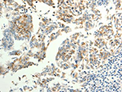 TRPC6 Antibody