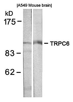 TRPC6 Antibody