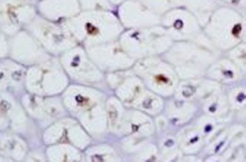 TRPC6 Rabbit Polyclonal Antibody