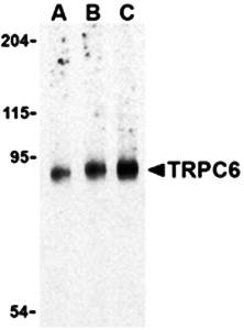 TRPC6 Antibody