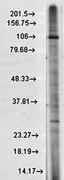 TRPC7 Antibody
