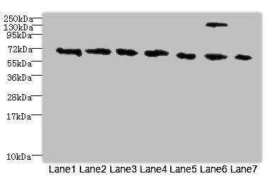 TRPM2 Antibody