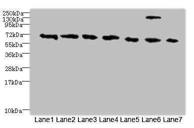 TRPM2 antibody