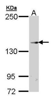 TRPM2 antibody