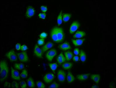 TRPM3 Antibody