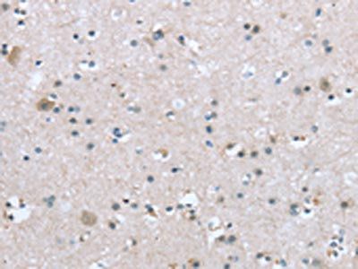 TRPM3 Antibody