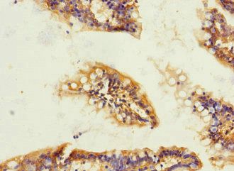 TRPM4 Antibody