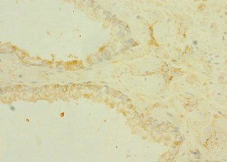 TRPM6 Antibody