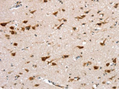 TRPM6 Antibody