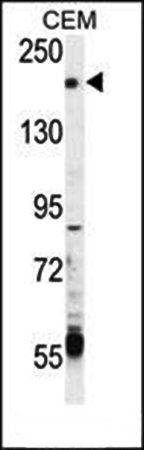 TRPM6 antibody