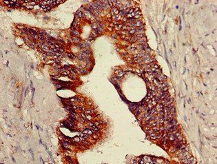 TRPV1 Antibody