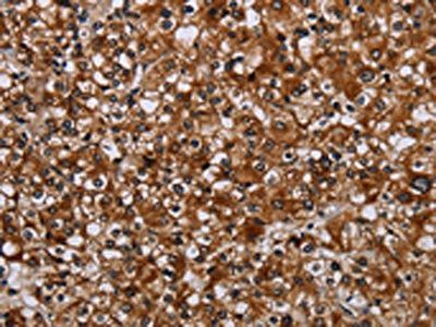 TRPV1 Antibody