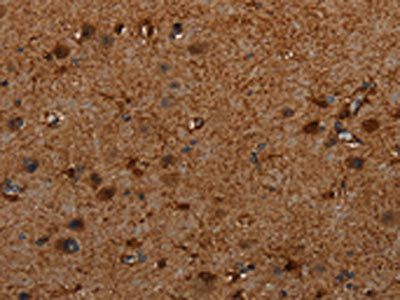 TRPV1 Antibody