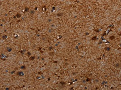 TRPV1 antibody