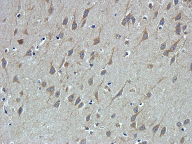 TRPV1 Rabbit Polyclonal Antibody