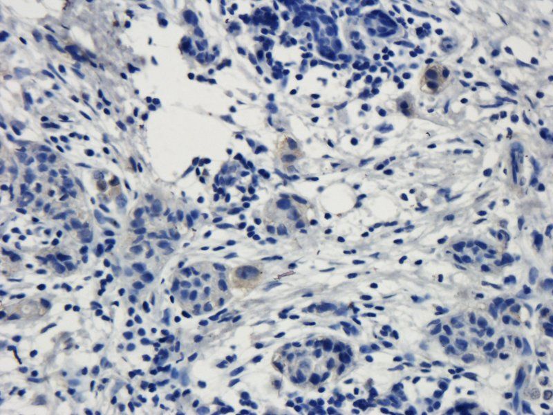 TRPV1 antibody