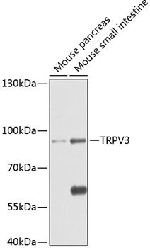 TRPV3 antibody